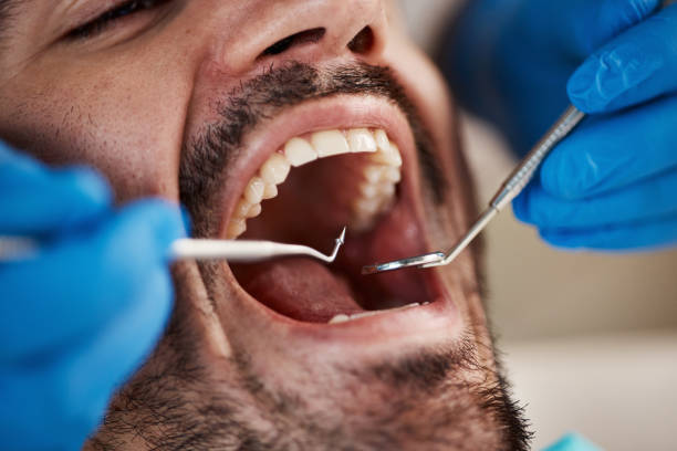 Emergency Dental Services in Bryant, WA